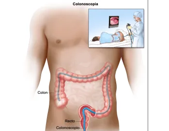 Endoscopia Gastrointestinal Leon Gto