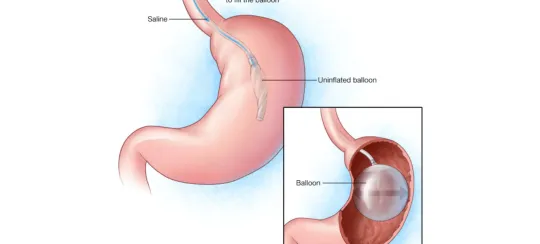 Endoscopia Gastrointestinal Leon Gto