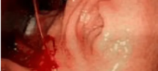 Endoscopia Gastrointestinal Leon Gto