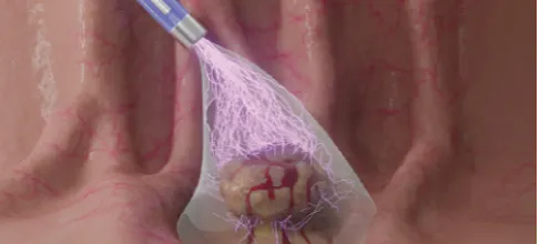 Endoscopia Gastrointestinal Leon Gto