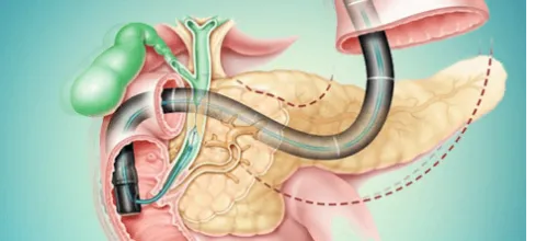 Endoscopia Gastrointestinal Leon Gto